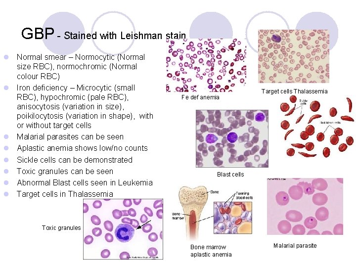 GBP - Stained with Leishman stain l Normal smear – Normocytic (Normal size RBC),