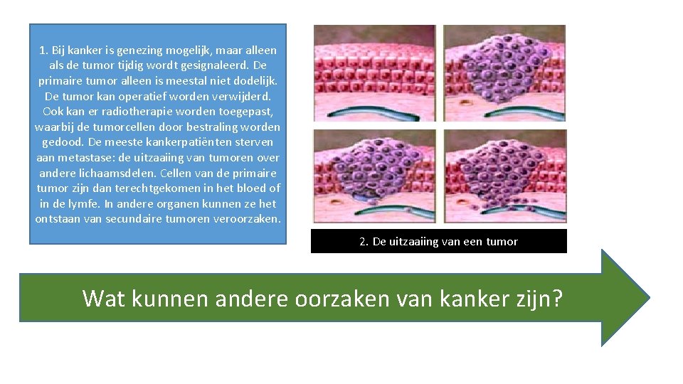 1. Bij kanker is genezing mogelijk, maar alleen als de tumor tijdig wordt gesignaleerd.