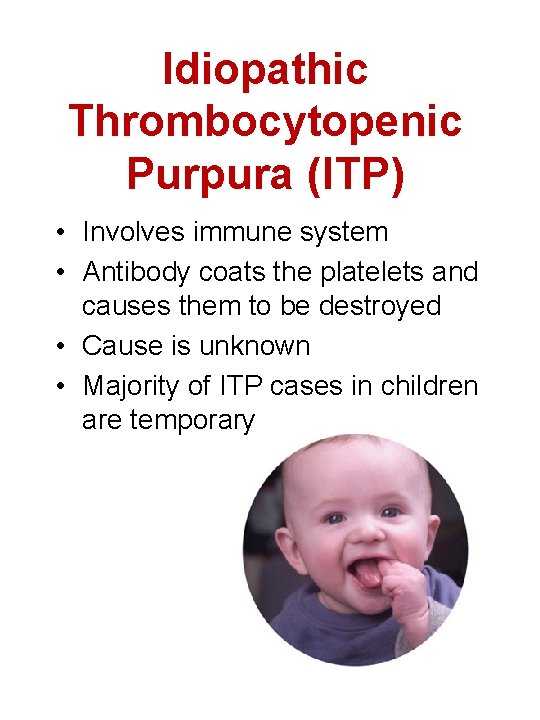 Idiopathic Thrombocytopenic Purpura (ITP) • Involves immune system • Antibody coats the platelets and