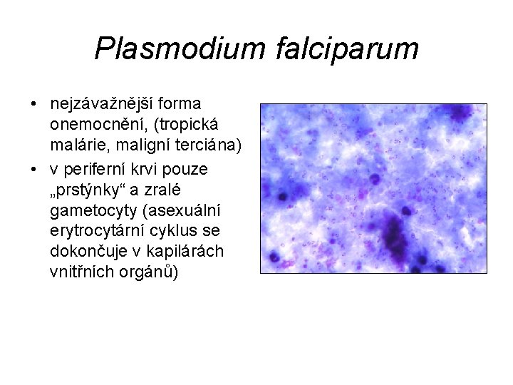 Plasmodium falciparum • nejzávažnější forma onemocnění, (tropická malárie, maligní terciána) • v periferní krvi
