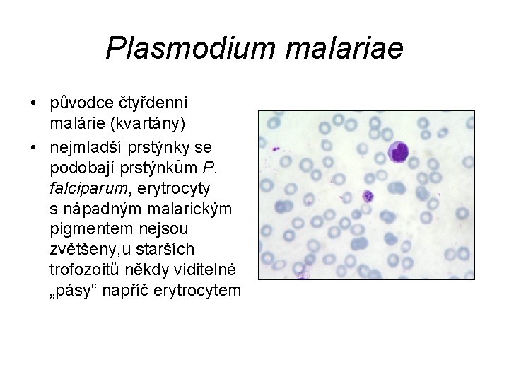 Plasmodium malariae • původce čtyřdenní malárie (kvartány) • nejmladší prstýnky se podobají prstýnkům P.