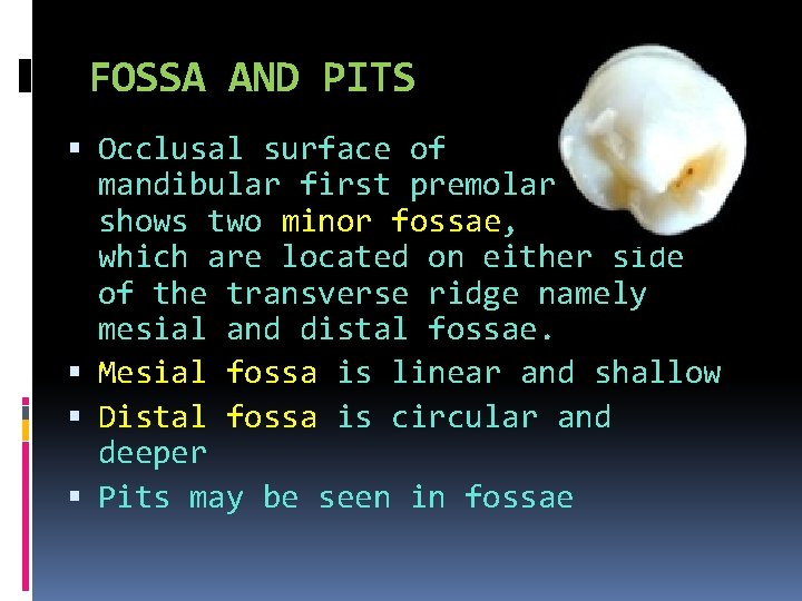 FOSSA AND PITS Occlusal surface of mandibular first premolar shows two minor fossae, which