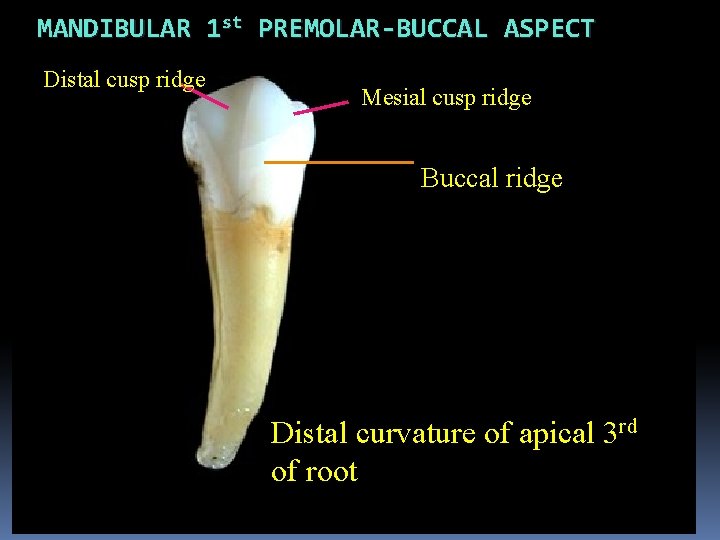 MANDIBULAR 1 st PREMOLAR-BUCCAL ASPECT Distal cusp ridge Mesial cusp ridge Buccal ridge Distal