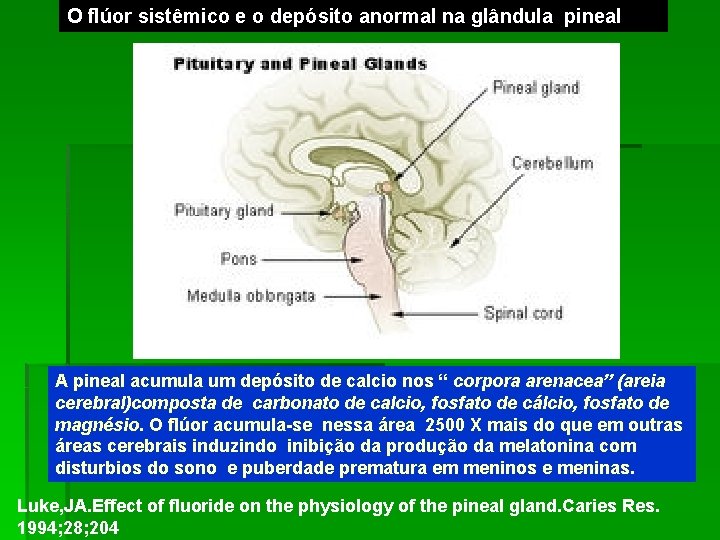 O flúor sistêmico e o depósito anormal na glândula pineal A pineal acumula um