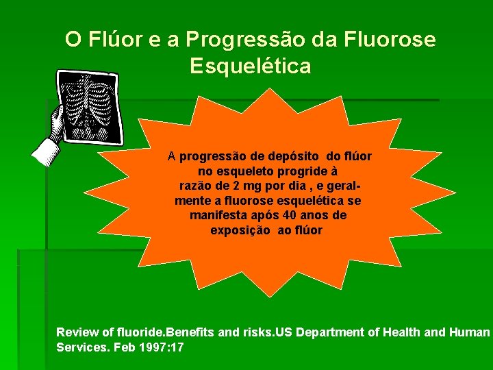 O Flúor e a Progressão da Fluorose Esquelética A progressão de depósito do flúor