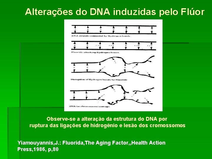 Alterações do DNA induzidas pelo Flúor Observe-se a alteração da estrutura do DNA por