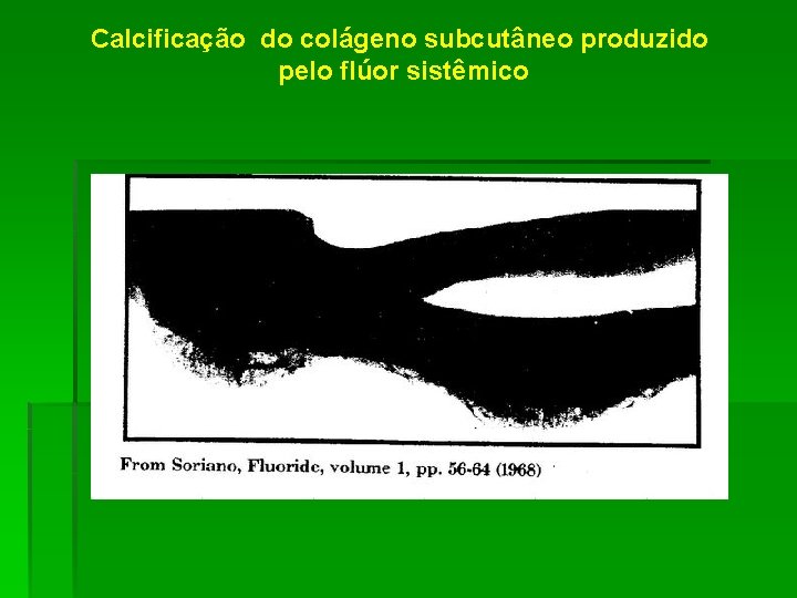 Calcificação do colágeno subcutâneo produzido pelo flúor sistêmico 