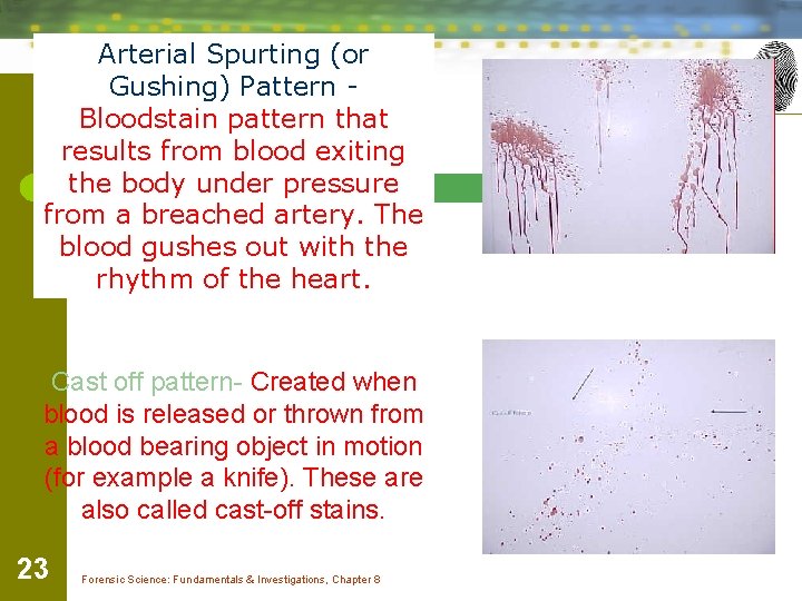 Arterial Spurting (or Gushing) Pattern Bloodstain pattern that results from blood exiting the body