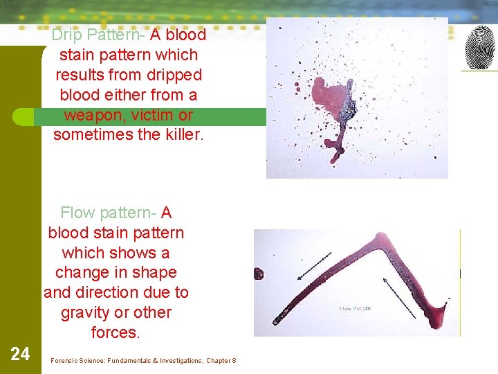 Drip Pattern- A blood stain pattern which results from dripped blood either from a
