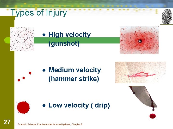 Types of Injury 27 l High velocity (gunshot) l Medium velocity (hammer strike) l