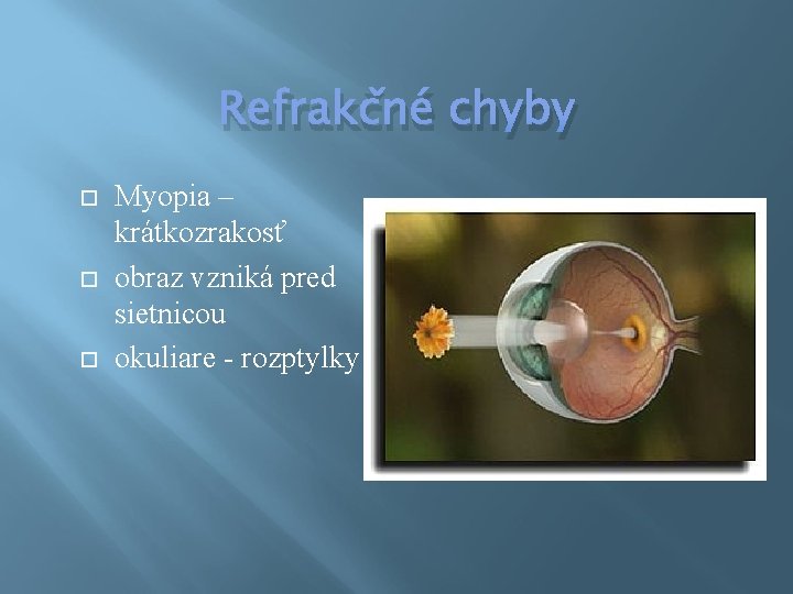 Refrakčné chyby Myopia – krátkozrakosť obraz vzniká pred sietnicou okuliare - rozptylky 