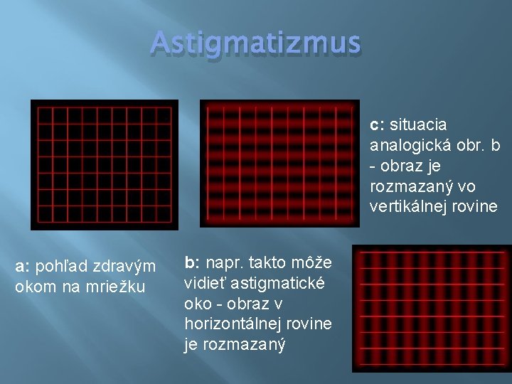 Astigmatizmus c: situacia analogická obr. b - obraz je rozmazaný vo vertikálnej rovine a: