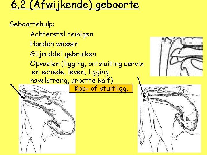 6. 2 (Afwijkende) geboorte Geboortehulp: Achterstel reinigen Handen wassen Glijmiddel gebruiken Opvoelen (ligging, ontsluiting