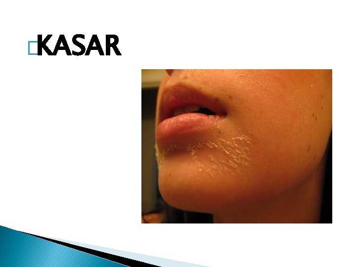 �KASAR 