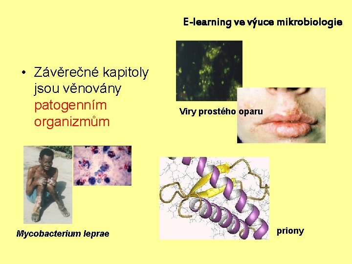 E-learning ve výuce mikrobiologie • Závěrečné kapitoly jsou věnovány patogenním organizmům Mycobacterium leprae Viry