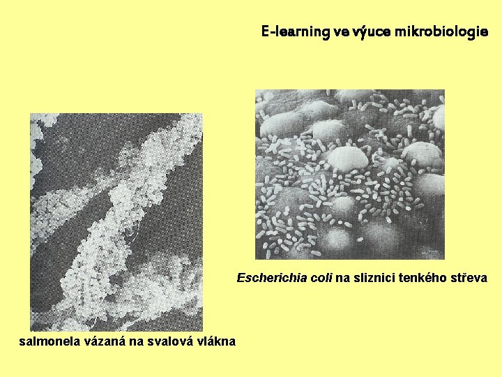 E-learning ve výuce mikrobiologie Escherichia coli na sliznici tenkého střeva salmonela vázaná na svalová