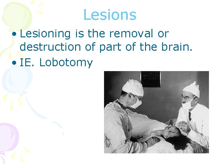 Lesions • Lesioning is the removal or destruction of part of the brain. •