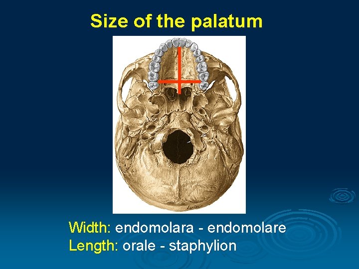 Size of the palatum Width: endomolara - endomolare Length: orale - staphylion 