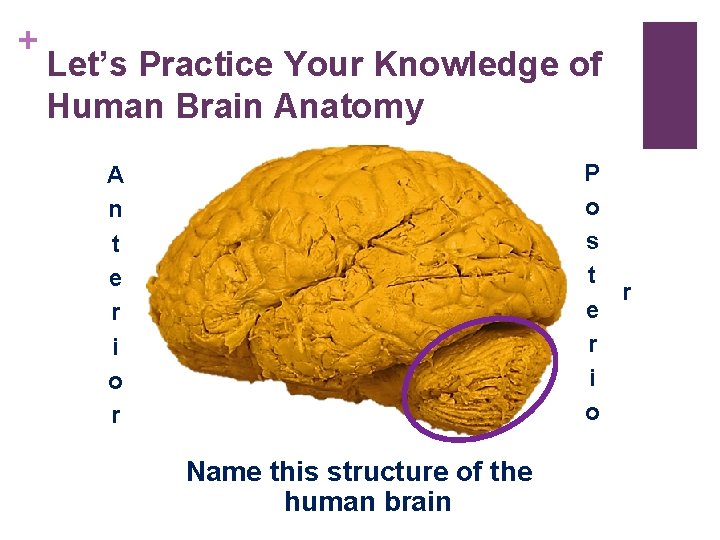 + Let’s Practice Your Knowledge of Human Brain Anatomy P o s t r + Let’s Practice Your Knowledge of Human Brain Anatomy P o s t r