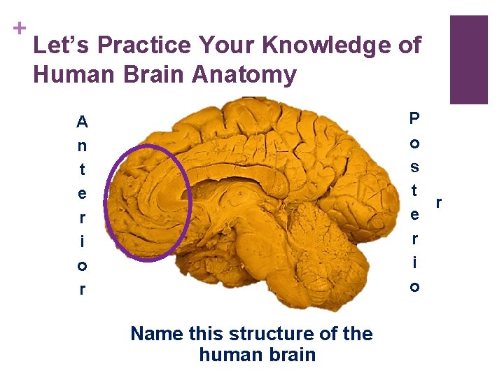 + Let’s Practice Your Knowledge of Human Brain Anatomy P o s t r + Let’s Practice Your Knowledge of Human Brain Anatomy P o s t r
