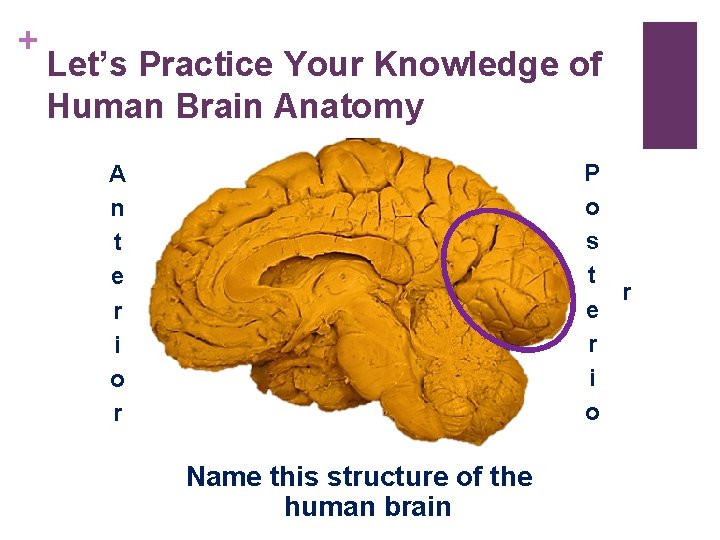 + Let’s Practice Your Knowledge of Human Brain Anatomy P o s t r + Let’s Practice Your Knowledge of Human Brain Anatomy P o s t r