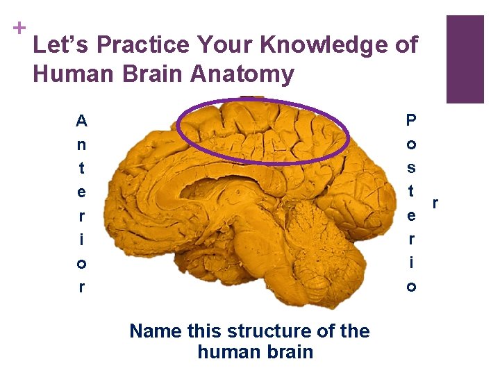 + Let’s Practice Your Knowledge of Human Brain Anatomy P o s t r + Let’s Practice Your Knowledge of Human Brain Anatomy P o s t r