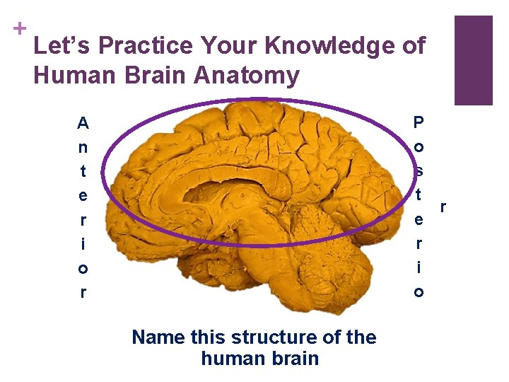 + Let’s Practice Your Knowledge of Human Brain Anatomy P o s t r + Let’s Practice Your Knowledge of Human Brain Anatomy P o s t r