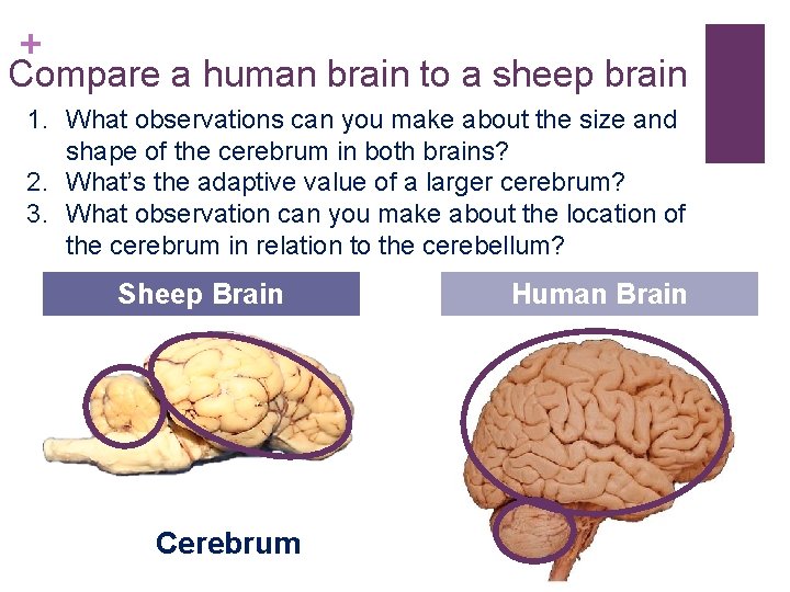 + Compare a human brain to a sheep brain 1. What observations can you + Compare a human brain to a sheep brain 1. What observations can you