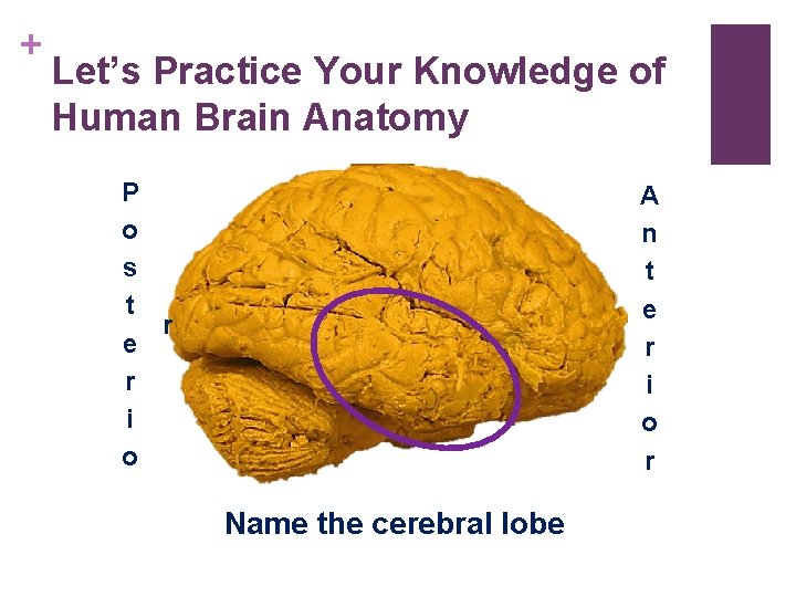 + Let’s Practice Your Knowledge of Human Brain Anatomy P o s t r + Let’s Practice Your Knowledge of Human Brain Anatomy P o s t r