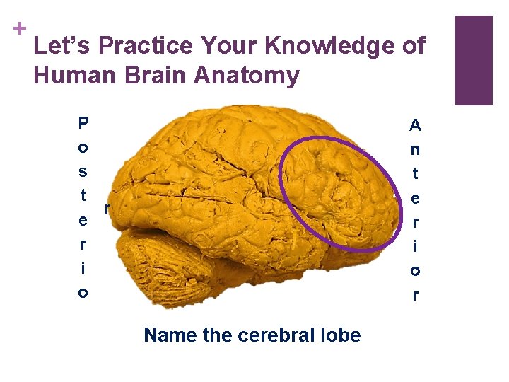 + Let’s Practice Your Knowledge of Human Brain Anatomy P o s t r + Let’s Practice Your Knowledge of Human Brain Anatomy P o s t r