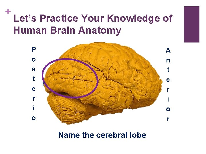 + Let’s Practice Your Knowledge of Human Brain Anatomy P o s t r + Let’s Practice Your Knowledge of Human Brain Anatomy P o s t r