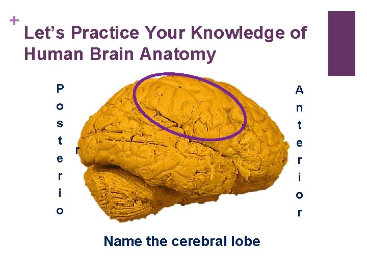 + Let’s Practice Your Knowledge of Human Brain Anatomy P o s t r + Let’s Practice Your Knowledge of Human Brain Anatomy P o s t r