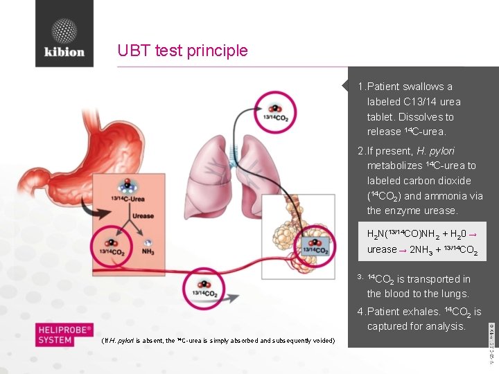 UBT test principle 1. Patient swallows a labeled C 13/14 urea tablet. Dissolves to