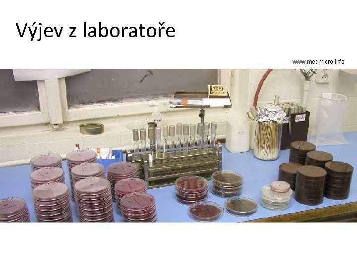 Výjev z laboratoře www. medmicro. info 