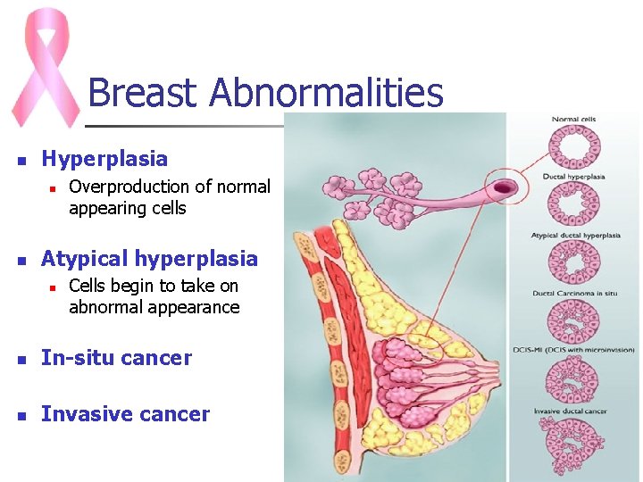 Breast Abnormalities n Hyperplasia n n Overproduction of normal appearing cells Atypical hyperplasia n