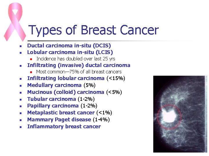 Types of Breast Cancer n n Ductal carcinoma in-situ (DCIS) Lobular carcinoma in-situ (LCIS)