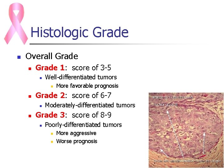 Histologic Grade n Overall Grade n Grade 1: score of 3 -5 n Well-differentiated