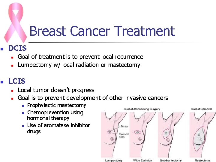 Breast Cancer Treatment n DCIS n n n Goal of treatment is to prevent