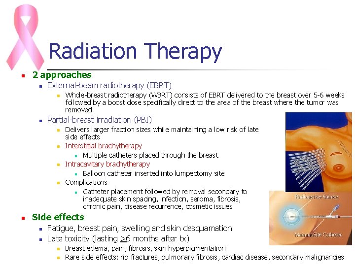 Radiation Therapy n 2 approaches n External-beam radiotherapy (EBRT) n n Partial-breast irradiation (PBI)