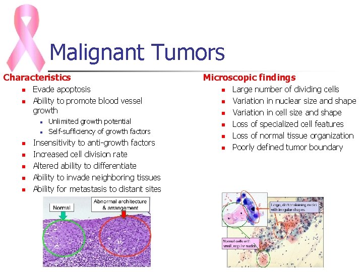 Malignant Tumors Characteristics n n Evade apoptosis Ability to promote blood vessel growth n