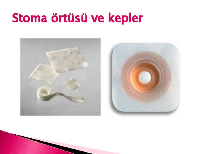 Stoma örtüsü ve kepler 