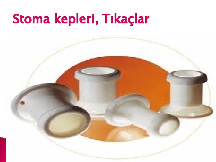 Stoma kepleri, Tıkaçlar 