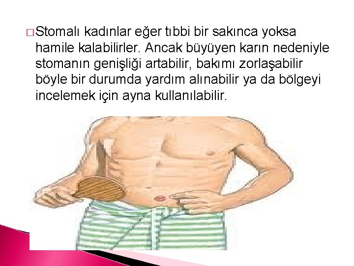 � Stomalı kadınlar eğer tıbbi bir sakınca yoksa hamile kalabilirler. Ancak büyüyen karın nedeniyle
