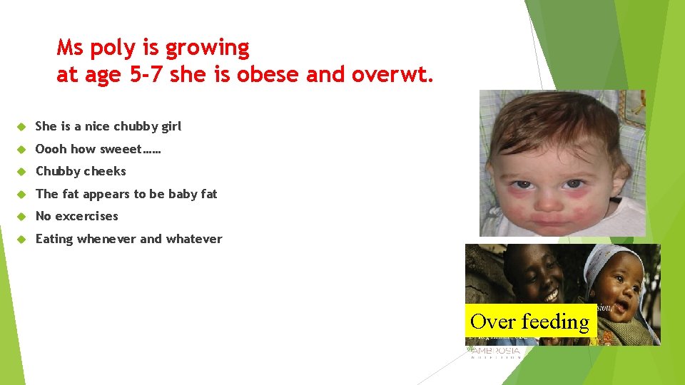 Ms poly is growing at age 5 -7 she is obese and overwt. She