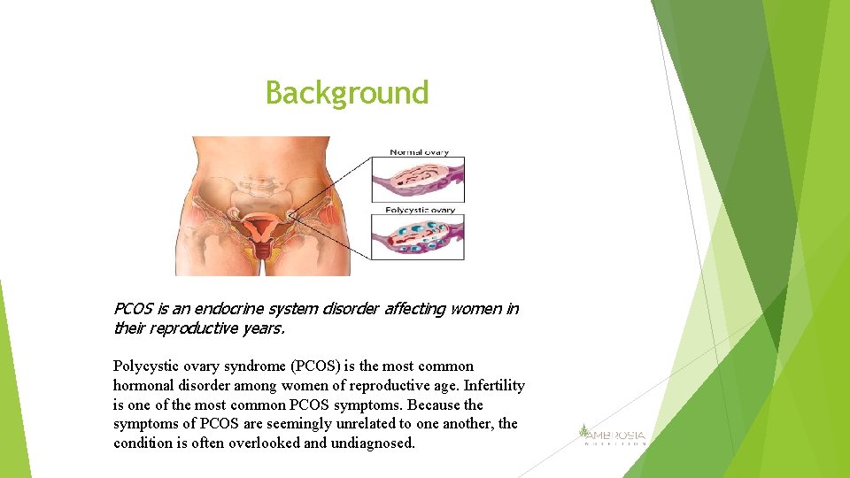 Background PCOS is an endocrine system disorder affecting women in their reproductive years. Polycystic