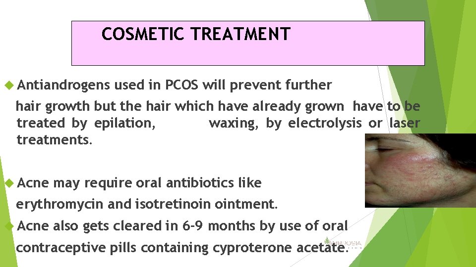 COSMETIC TREATMENT Antiandrogens used in PCOS will prevent further hair growth but the hair