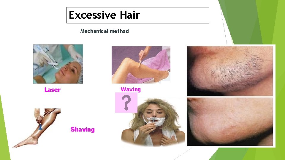 Excessive Hair Mechanical method Laser Waxing Shaving 