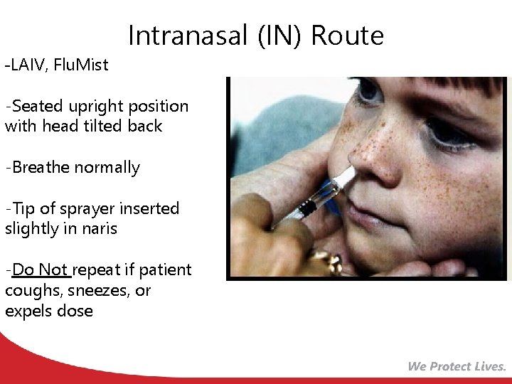 Intranasal (IN) Route -LAIV, Flu. Mist -Seated upright position with head tilted back -Breathe