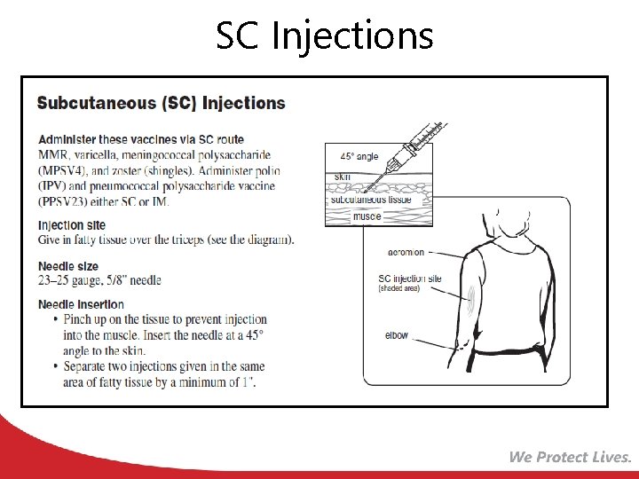 SC Injections 