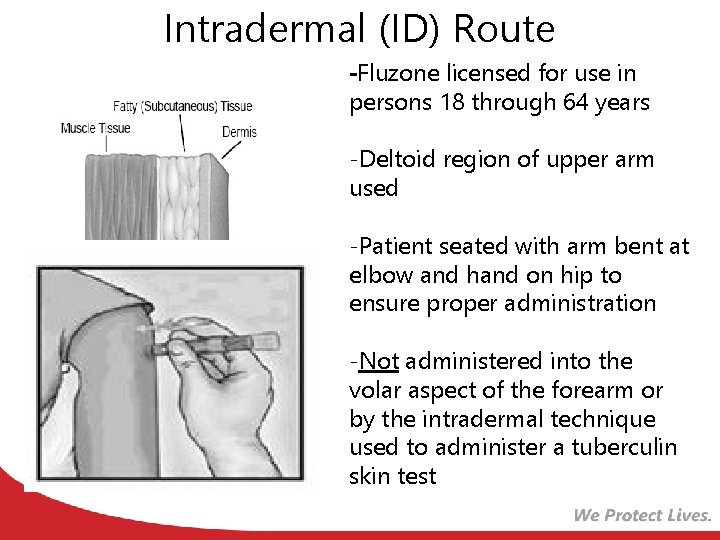 Intradermal (ID) Route -Fluzone licensed for use in persons 18 through 64 years -Deltoid